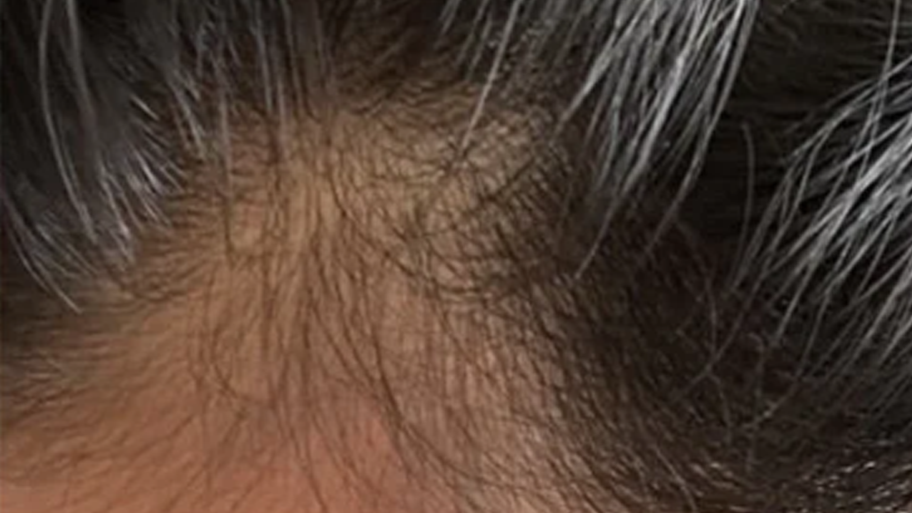 EMS HEAD SPA PRO-after